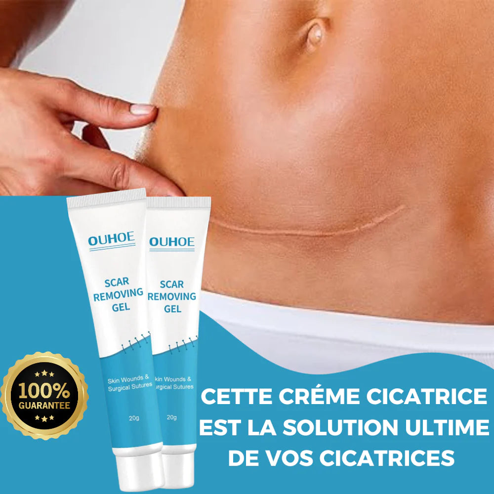 Crème d'élimination des cicatrices | 2 unités